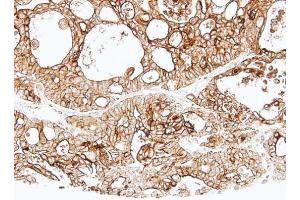 IHC-P Image Immunohistochemical analysis of paraffin-embedded human Breast, using ALPPL2, antibody at 1:500 dilution.