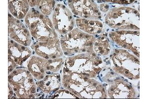 Immunohistochemistry (IHC) image for anti-Acetyl-CoA Acetyltransferase 2 (ACAT2) antibody (ABIN1496397) (ACAT2 Antikörper)