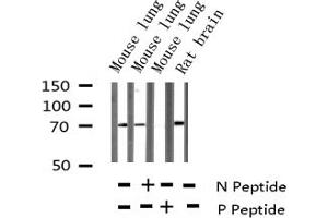 Western blot analysis of Phospho-DRP-2 (Thr514) expression in various lysates