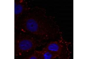 Immunofluorescence staining of methanol-fixed Hela cells using Paxillin(phospho-Tyr88) Antibody. (Paxillin Antikörper  (pTyr88))