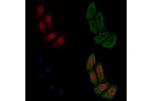 ABIN6255221 and ABIN6267478 staining HepG2 cells(4h of LPS treatment) by IF/ICC. (beta Catenin Antikörper  (pSer33))