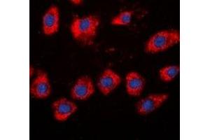 Immunofluorescent analysis of Beta-adducin staining in HeLa cells. (ADD2 Antikörper)