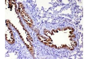IHC testing of FFPE rat lung tissue with WFDC2 antibody at 1ug/ml.
