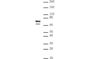 Lamin A/C mAb (Clone 3A6-4C11) tested by Western blot. (Lamin A/C Antikörper  (AA 430-545))
