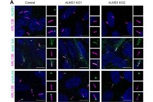 Immunofluorescence staining of wild-type and Tubb4ab KO respiratory MCC at P1 showing specific staining of Tubb4 (magenta), Arl13b( cat. (ARL13B Antikörper  (C-Term))
