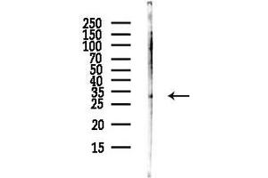 Western blot analysis of lysates from HUVEC cells(UV,30 min treatment), using WNB Antibody at 1/1000 dilution.