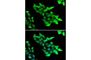Immunofluorescence analysis of HeLa cells using KRIT1 antibody (ABIN5974145). (KRIT1 Antikörper)