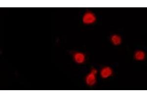 ABIN6272320 staining Hela by IF/ICC. (HDAC9 Antikörper  (C-Term))