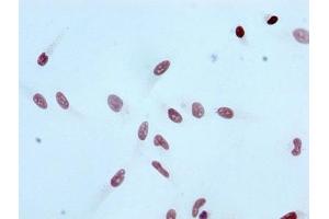 Immunocytochemistry analysis of ABIN7127269 diluted at 1:100 and staining in Hela cells performed on a Leica BondTM system. (Rekombinanter HIST1H3A Antikörper  (H3K4ac))