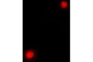 Immunofluorescent analysis of PC4 staining in A549 cells. (SUB1 Antikörper)