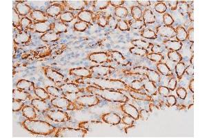 Immunohistochemistry (IHC) image for anti-Spleen tyrosine Kinase (SYK) (pTyr348) antibody (ABIN6255895)