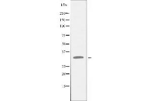 Western blot analysis of extracts from Jurkat cells, using BST1 antibody. (BST1 Antikörper  (Internal Region))