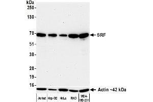 Western Blotting (WB) image for anti-Serum Response Factor (SRF) (AA 25-75) antibody (ABIN7795720)