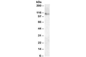 Western blot testing of human kidney lysate with ATP13A1 antibody at 0. (ATP13A1 Antikörper)