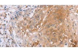 Immunohistochemistry (Paraffin-embedded Sections) (IHC (p)) image for anti-Leukocyte Immunoglobulin-Like Receptor, Subfamily B (With TM and ITIM Domains), Member 2 (LILRB2) antibody (ABIN7244522)