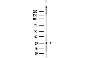 anti-Ring Finger Protein 167 (RNF167) (Internal Region) antibody