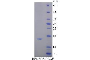 Image no. 1 for Cystatin C (CST3) (AA 21-140) protein (His tag) (ABIN6236703) (CST3 Protein (AA 21-140) (His tag))