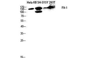 Western Blot (WB) analysis of HeLa, KB, SH-SY5Y, 293T lysis using Flt-1 antibody. (FLT1 Antikörper  (Ser385))
