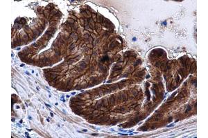 IHC-P Image E-Cadherin antibody detects E-Cadherin protein at cell membrane and cytoplasm in mouse prostate by immunohistochemical analysis. (E-cadherin Antikörper)