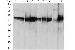 Western Blotting (WB) image for anti-3-phosphoinositide Dependent Protein Kinase-1 (PDPK1) (AA 457-556) antibody (ABIN5855659) (PDPK1 Antikörper  (AA 457-556))