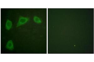 Immunofluorescence analysis of HuvEc cells, using Caveolin 1 antibody. (Caveolin-1 Antikörper  (C-Term))