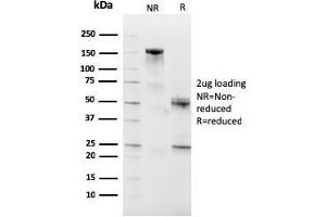 SDS-PAGE Analysis Purified CD10 Mouse Monoclonal Antibody (MME/2590). (MME Antikörper  (AA 297-483))
