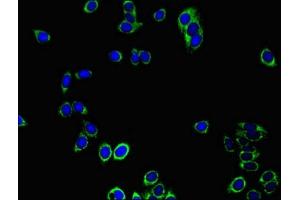 Immunofluorescent analysis of HepG2 cells using ABIN7172023 at dilution of 1:100 and Alexa Fluor 488-congugated AffiniPure Goat Anti-Rabbit IgG(H+L) (Peroxiredoxin 3 Antikörper  (AA 63-256))