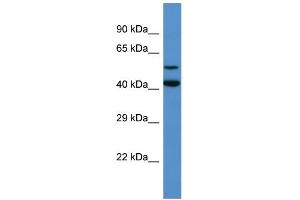 Western Blotting (WB) image for anti-Glutamate Decarboxylase-Like 1 (GADL1) (Middle Region) antibody (ABIN2774262) (GADL1 Antikörper  (Middle Region))
