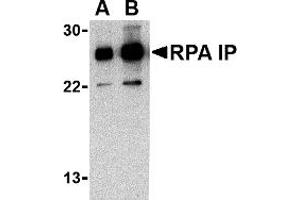 Western Blotting (WB) image for anti-RPA Interacting Protein (RPAIN) (C-Term) antibody (ABIN1030628) (RPAIN Antikörper  (C-Term))