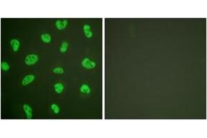 Immunofluorescence analysis of HeLa cells, using DNA-PK Antibody. (PRKDC Antikörper  (AA 4061-4110))