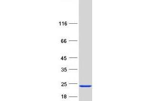 Western Blotting (WB) image for Neurocalcin delta (NCALD) (Transcript Variant 8) protein (Myc-DYKDDDDK Tag) (ABIN2726869)