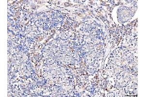 IHC analysis of Acid Phosphatase/ACP5 using anti-Acid Phosphatase/ACP5 antibody (ABIN7601574). (ACP5 Antikörper  (AA 39-325))