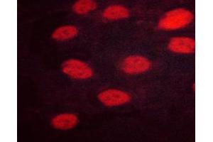 ABIN6267647 staining HeLa cells by ICC/IF.