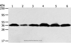 Western blot analysis of Hela cell and human liver cancer tissue, Raji, Jurkat, 293T and PC3 cell, using APEX1 Polyclonal Antibody at dilution of 1:450 (APEX1 Antikörper)