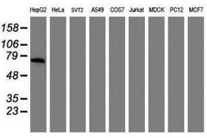 Image no. 2 for anti-alpha-Fetoprotein (AFP) antibody (ABIN1496491) (alpha Fetoprotein Antikörper)