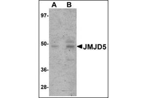 Western blot analysis of JMJD5 in human liver tissue lysate with this product at (A) 1 and (B) 2 μg/ml. (JMJD5 Antikörper  (C-Term))