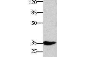Western Blot analysis of Mouse muscle tissue using HOXA11 Polyclonal Antibody at dilution of 1:350 (Homeobox A11 Antikörper)