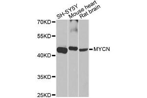 Western blot analysis of extracts of various cell lines, using MYCN antibody (ABIN5970179) at 1/1000 dilution. (MYCN Antikörper)