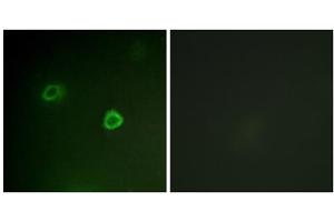 Immunofluorescence analysis of COS7 cells, using p90 RSK (Phospho-Thr573) antibody. (RPS6KA3 Antikörper  (pThr573))
