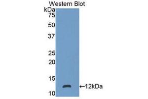 Western Blotting (WB) image for anti-S100 Calcium Binding Protein P (S100P) (AA 1-95) antibody (ABIN3205546) (S100P Antikörper  (AA 1-95))