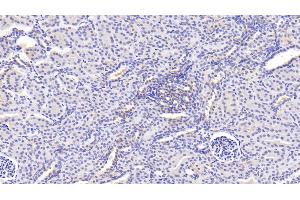 Detection of Pgp in Human Kidney Tissue using Polyclonal Antibody to Permeability Glycoprotein (Pgp)