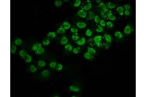 Immunofluorescence staining of Hela cells (treated with 30mM sodium butyrate for 4h) with ABIN7139151 at 1:2. (Histone H2B Antikörper  (acLys116))