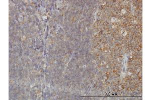 Immunostaining (ISt) image for anti-RAB21, Member RAS Oncogene Family (RAB21) (AA 116-225) antibody (ABIN564984)