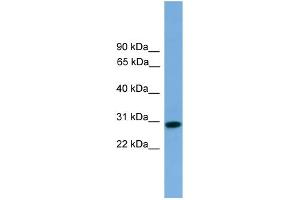 WB Suggested Anti-RCAN2 Antibody Titration: 0.