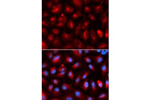 Immunofluorescence analysis of U2OS cells using KLC1 antibody. (KLC1 Antikörper  (AA 261-560))