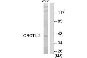 Western blot analysis of extracts from COLO205 cells, using ORCTL-2 antibody. (ORCTL-2/SLC22A18 Antikörper  (C-Term))