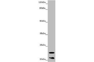Western blot All lanes: CRYGS antibody at 6. (CRYGS Antikörper  (AA 1-178))