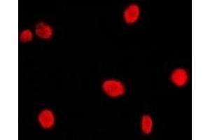 Immunofluorescent analysis of CBP20 staining in Hela cells. (NCBP2 Antikörper  (N-Term))