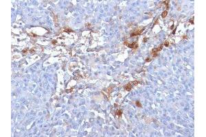 Image no. 3 for anti-Melanoma Cell Adhesion Molecule (MCAM) antibody (ABIN6153528) (MCAM Antikörper)