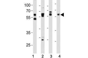 Western blot analysis of lysate from (1) HeLa, (2) mouse NIH3T3, (3) mouse C2C12, and (4) rat PC-12 cell line using SMAD2 antibody at 1:1000. (SMAD2 Antikörper  (AA 198-232))